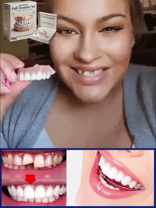 š¦·Full Denture Set - Image 4