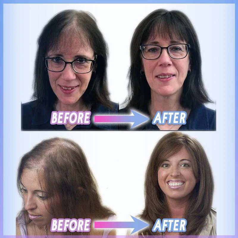 Magic Clip-on Hair Topper - Image 7
