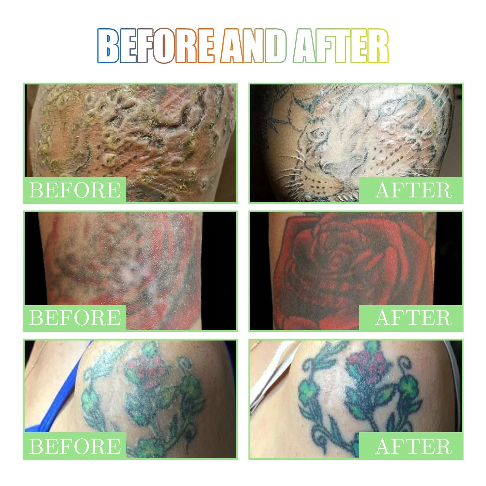 Tattoo Brightening Aftercare Balm - Image 10